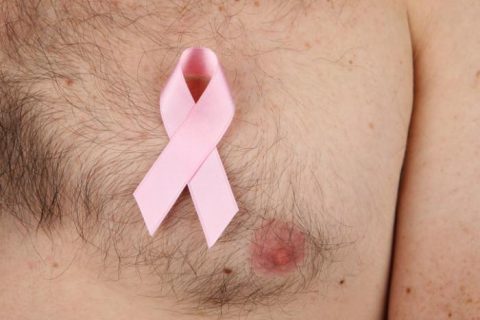 عکس سرطان سینه در مردان