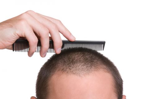 20 روش برای رشد مو